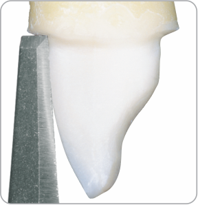 MA-1 (Beveling instrument)