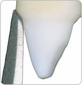 [10802] MA-2 (Beveling instrument)